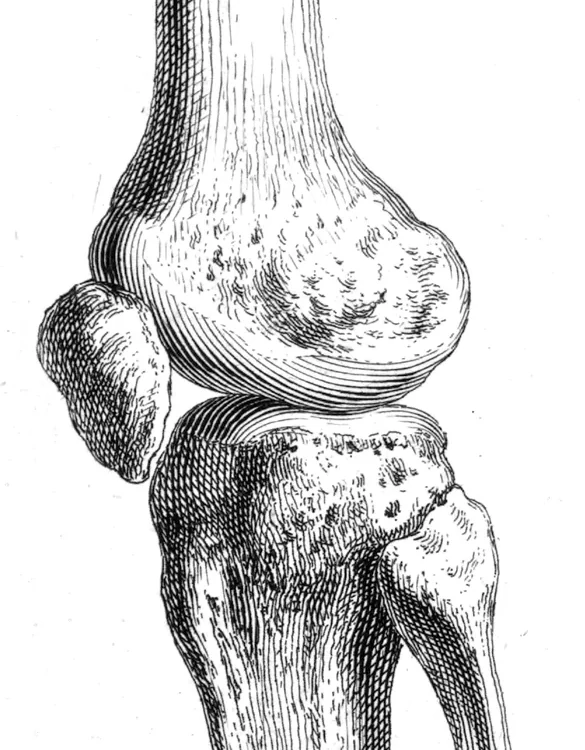 Gravură anatomică a articulației genunchiului — femur distal, rotulă, platou tibial